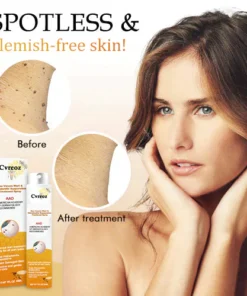 Cvreoz méhméreg szemölcs és címkéket eltávolító kezelő spray