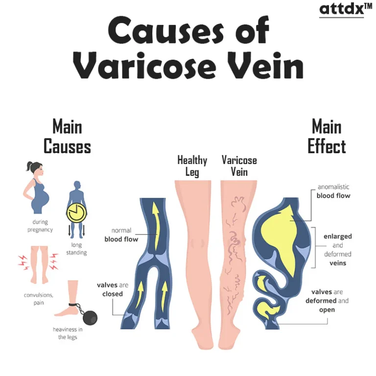ATTDX VaricoseVeins Soothing Spray - Image 6