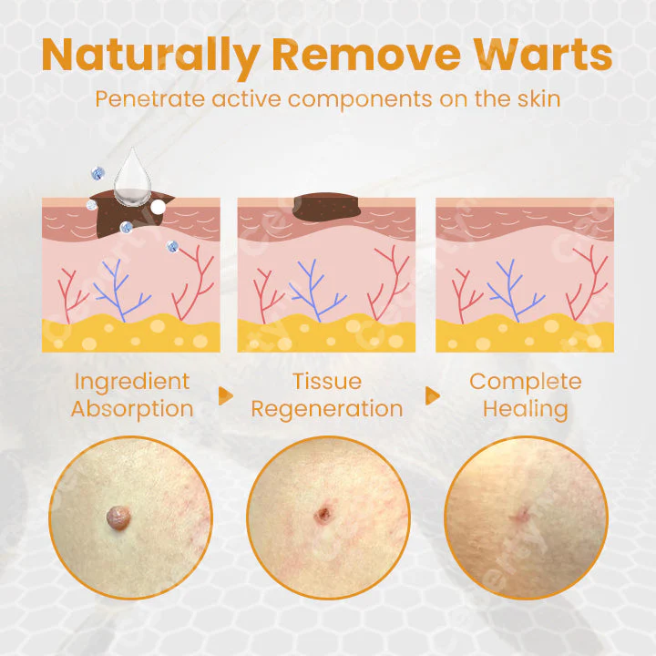 LIMETOW™ TagX Bee Venom Treatment Spray - Image 6