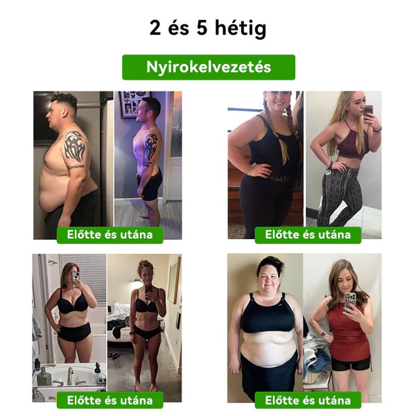 LUKMLCAM™ Méhméreg Nyirokméregtelenítő Karcsúsító Lábtapasz - Image 8