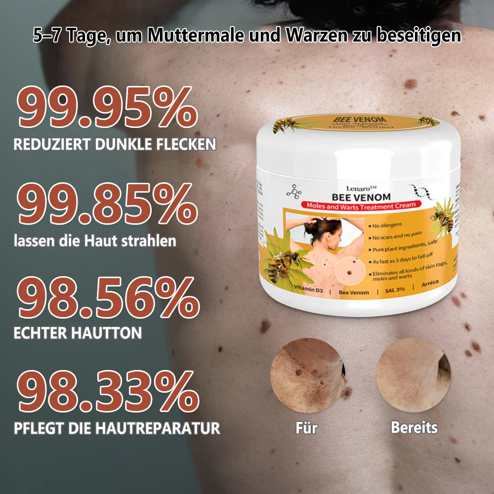 Lenaro™ Bienengift Maulwurf und Warze Behandlung Creme - Image 3