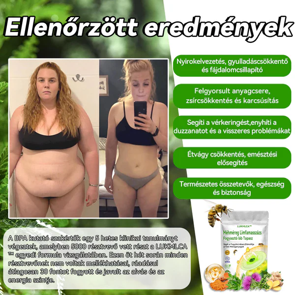 LUKMLCAM™ Méhméreg Nyirokméregtelenítő Karcsúsító Lábtapasz - Image 4