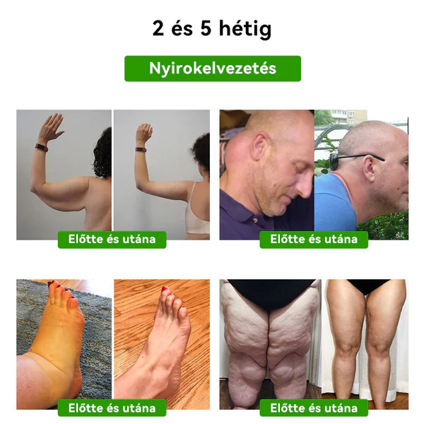 LUKMLCAM™ Méhméreg Nyirokméregtelenítő Karcsúsító Lábtapasz - Image 7