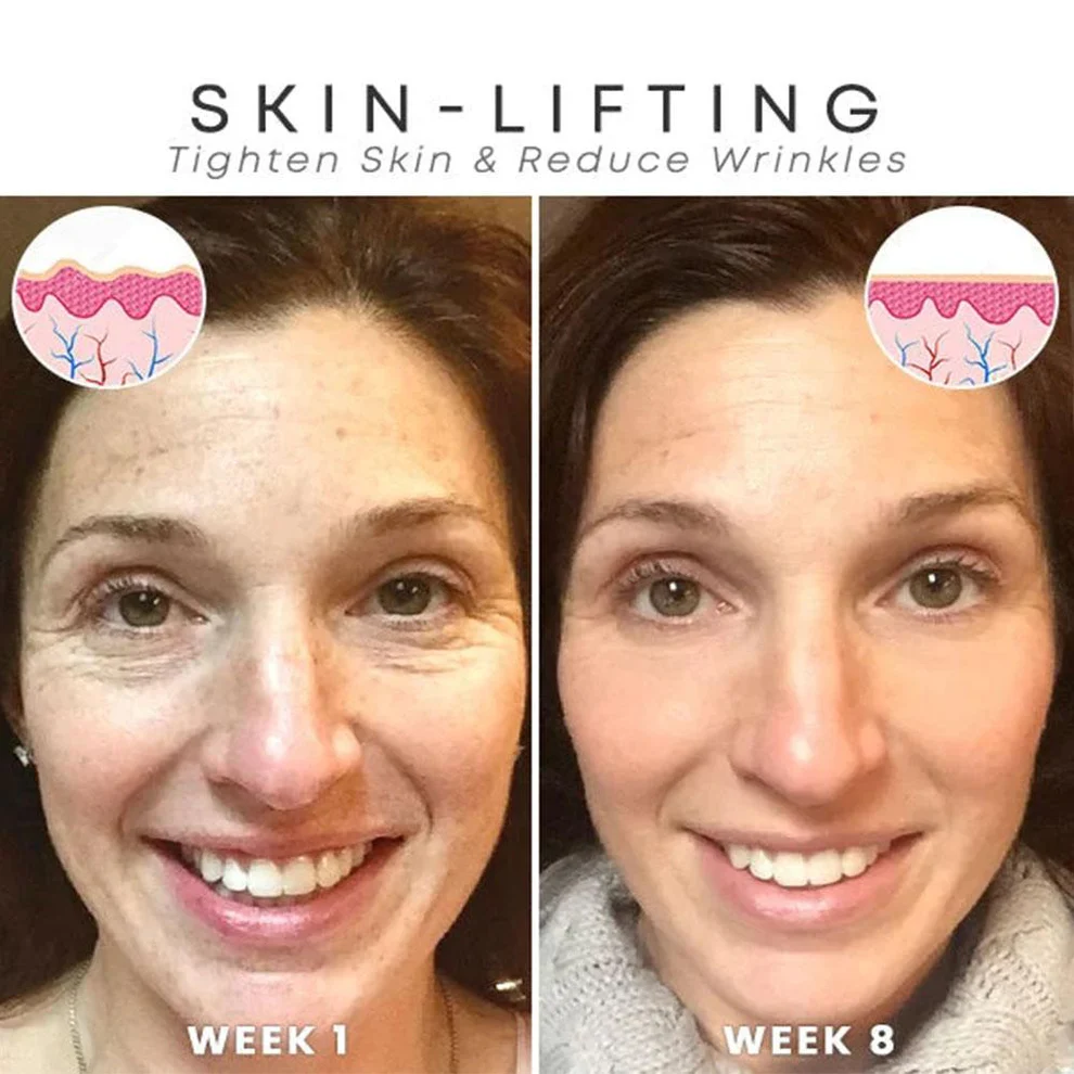 Hyalu B5 Pure Anti-Aging Face Serum - Image 12