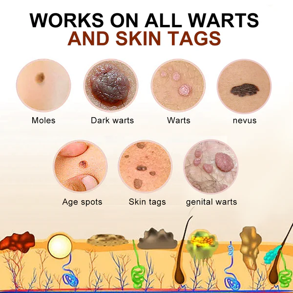 Lenaro™ Bee Venom Mole and Wart Treatment Cream - Image 5