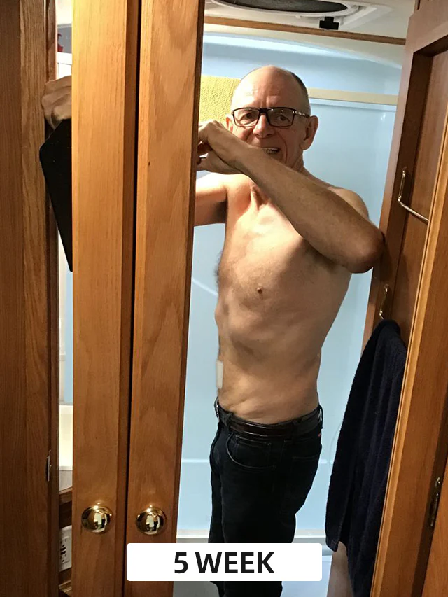 Furzero™ Bee Venom Detox Slimming Patch - Image 4