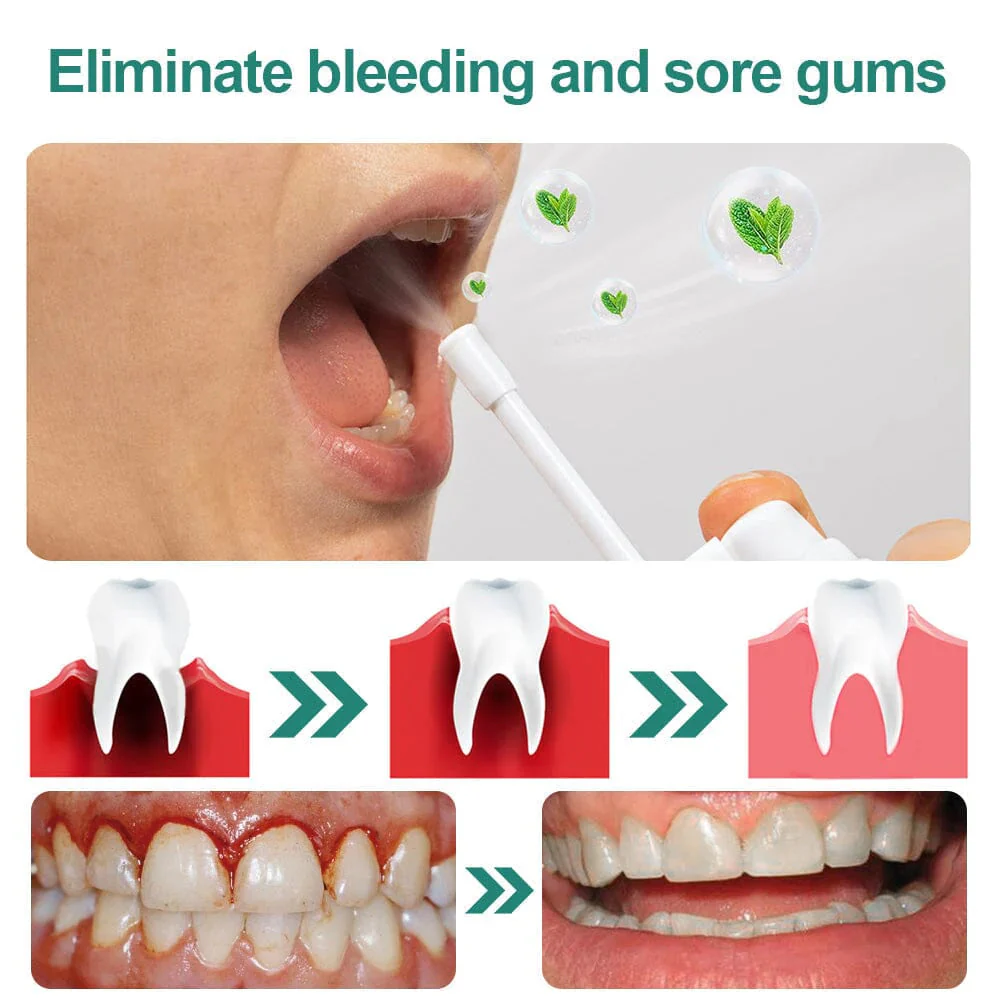 LIMETOW™ Ultra Healing Herbal Mouth Spray - Image 3