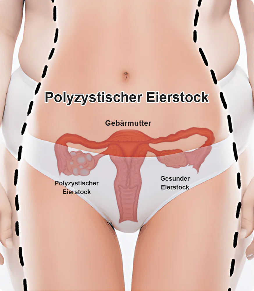 KKIO® Negative Ion Fettabbau, Bauchstraffung, Entgiftung formende Hosen - Image 13