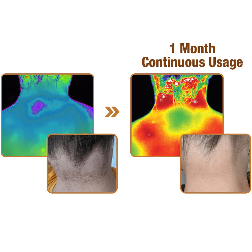 Dobshow™ ShineLuster Bee Venom Clinical Strength Soap for Skin Clarity - Image 9