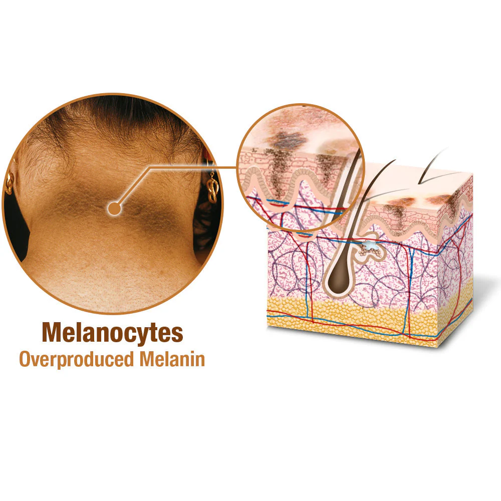 Dobshow™ ShineLuster Bee Venom Clinical Strength Soap for Skin Clarity - Image 8