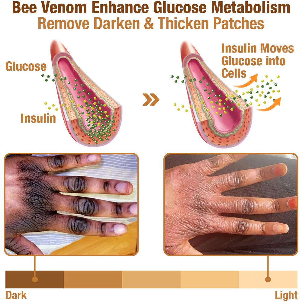 Dobshow™ ShineLuster Bee Venom Clinical Strength Soap for Skin Clarity - Image 4