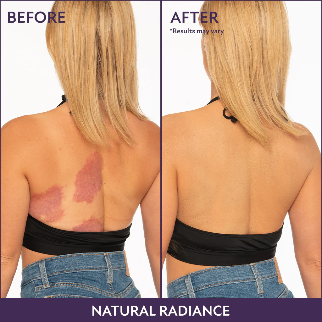 Body Coverage Perfector - Image 3