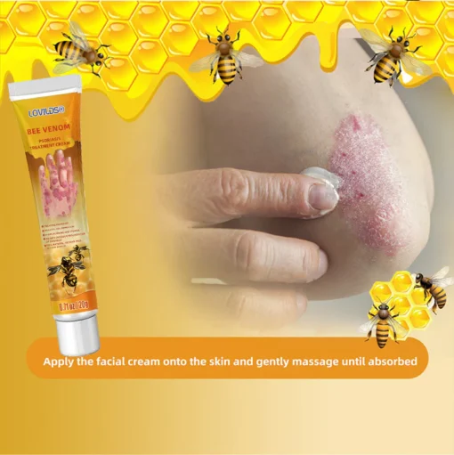 LOVILDS® Erle Pozoia Psoriasia Tratatzeko Krema - 4. Irudia