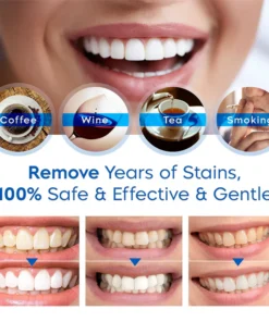 Alternative view of LUMINA™ Teeth Whitening Essence