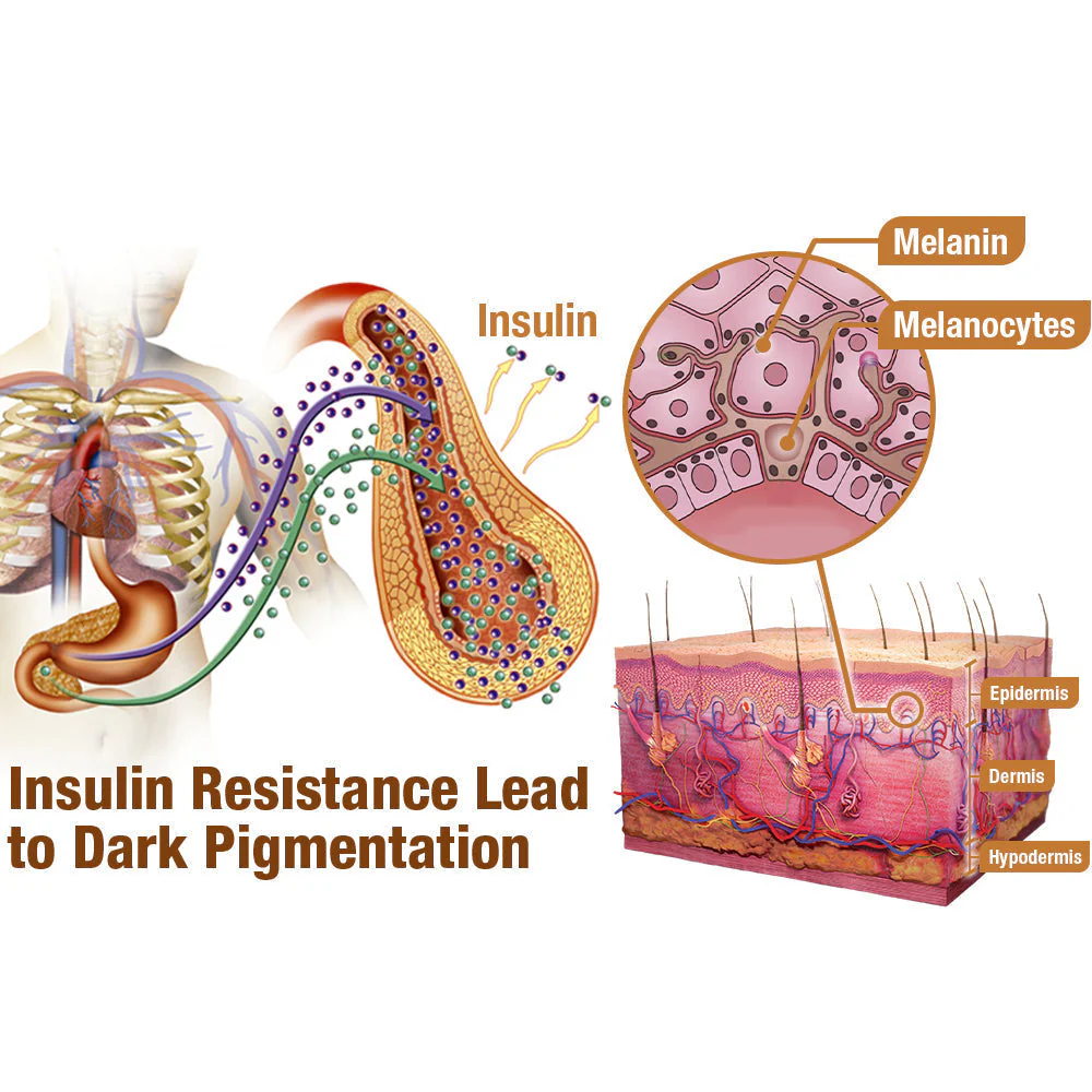Dobshow™ ShineLuster Bee Venom Clinical Strength Soap for Skin Clarity - Image 7