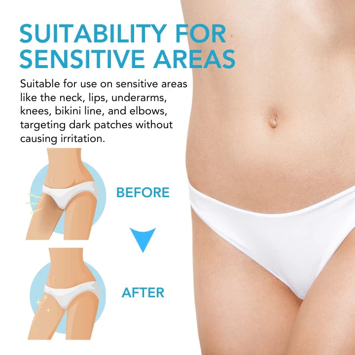 Fivfivgo ™ Acanthosis Nigricans Aufhellungscreme - Ìomhaigh 3