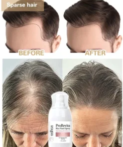 Alternative view of Rice Water Hair Growth Spray