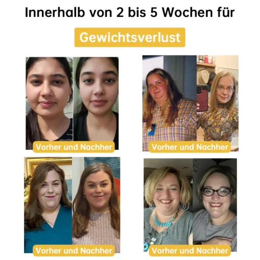 Ourlyard™ Bienengift Entgiftungs-Schlankheitspflaster - 4. irudia