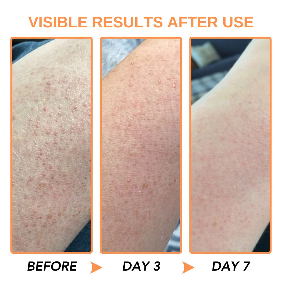 Negusy™ KeraTone Bee Venom Soap - Image 8