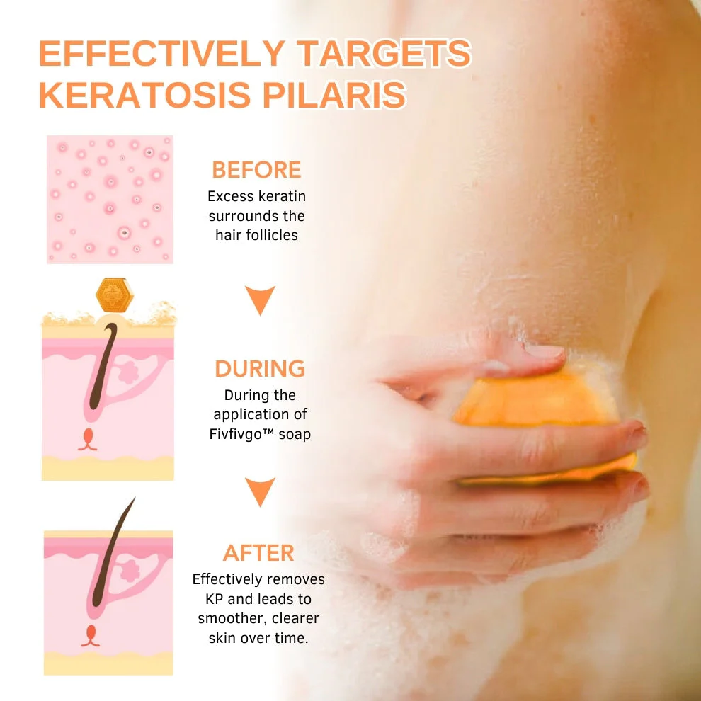 Negusy™ KeraTone Bee Venom Soap - Image 7