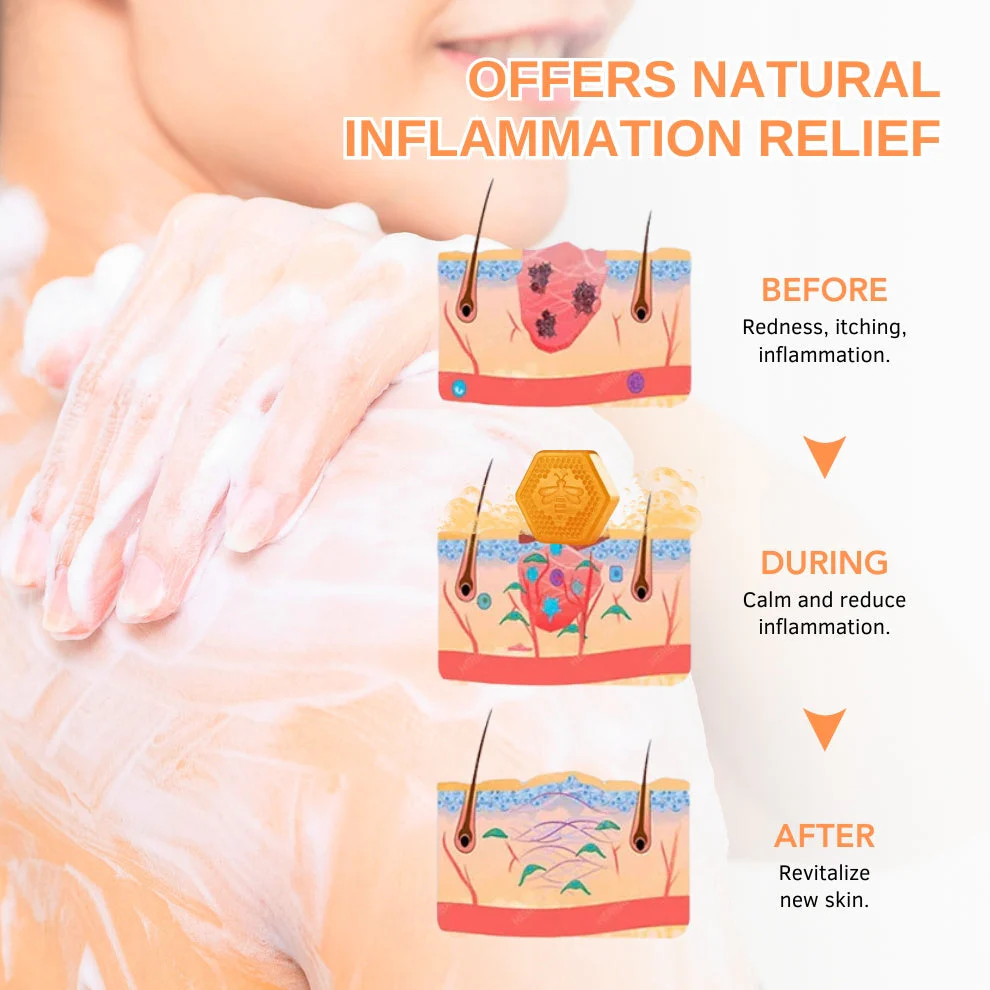 Negusy™ KeraTone Bee Venom Soap - Image 6