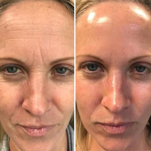 Fivfivgo™ Retinol Vitamin Jugendliche Ausstrahlung HydraFirm Bar - Image 6