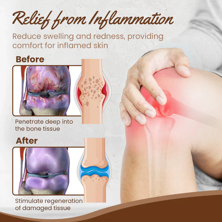 Fivfivgo™ Bio-Kräutersalbe - Image 5