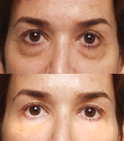 Beeveil™ Crystal Collagen Eye Mask - Ofbylding 8