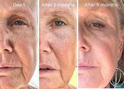 Fivfivgo™ Botox Anti-Ageing-Serum - Hoto 4
