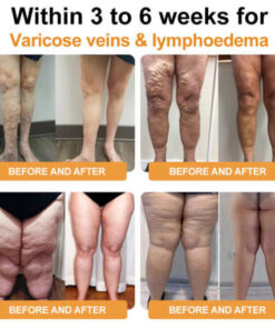 Alternative view of Joint & Bone Therapy Turmeric Ginger Treatment Spray