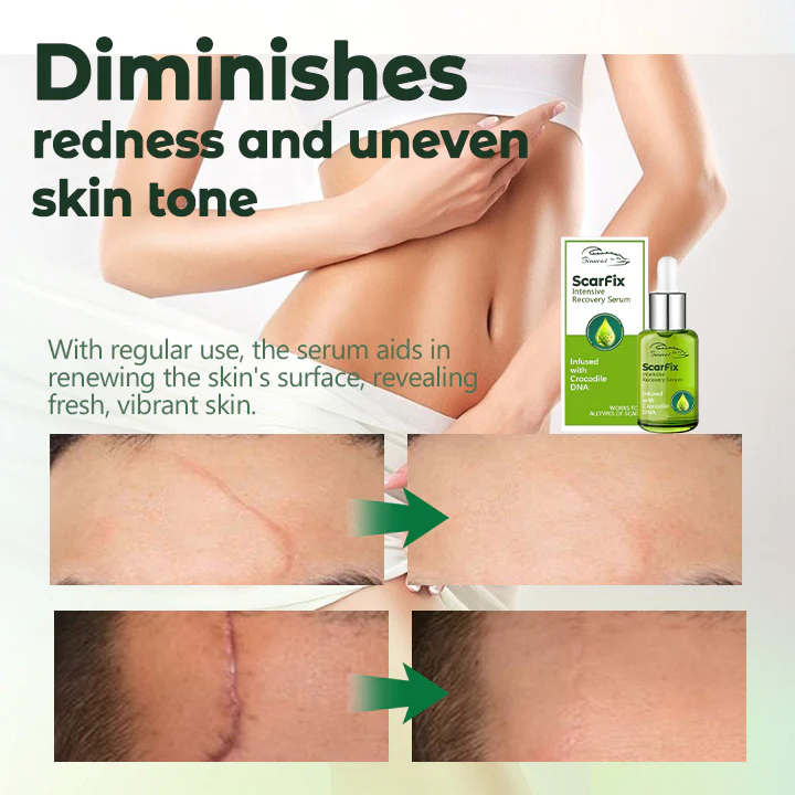 Biancat™ ScarFix Siero intensivo di recupero - Immagine 24