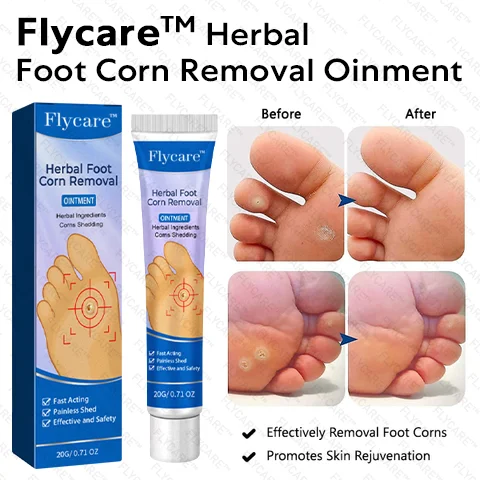 FLYCARE™ Herbal Foot Corn Removal Ointment