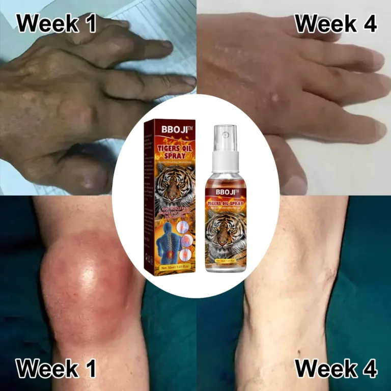 Joint And Bone Theraty BBOJI™ Tigers Oil Spray - Image 6