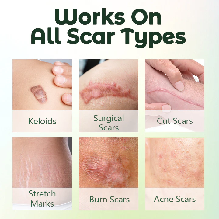 Biancat™ ScarFix Siero intensivo di recupero - Immagine 21