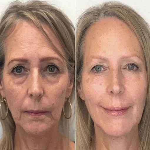 PEPTIDE Wrinkle Reducing Cream - Image 10