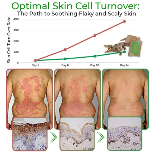 GFOUK™ Crócil Crocodile Oil Repair Aleppo Soap - Image 9