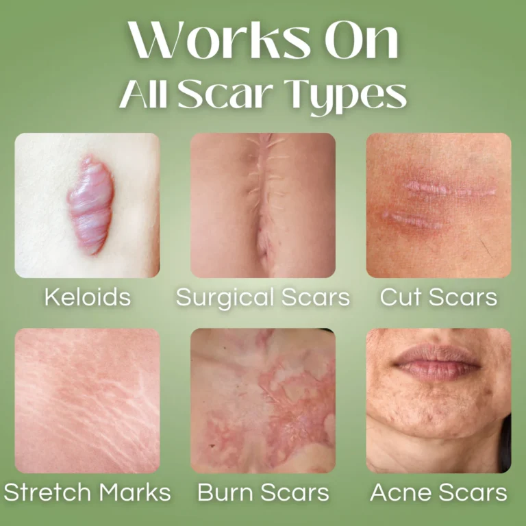 Oveallgo™ Scar Repair Essence - Image 5