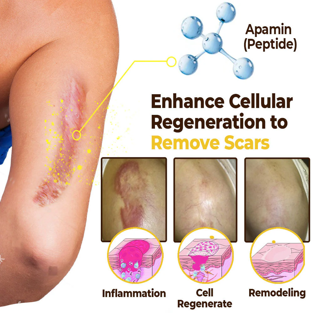 GFOUK ™ CicatrixCare Bee Venom Therapy Spray - Ìomhaigh 10