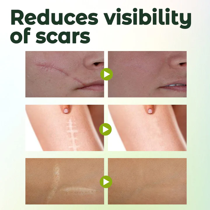 Biancat™ ScarFix Siero intensivo di recupero - Immagine 12