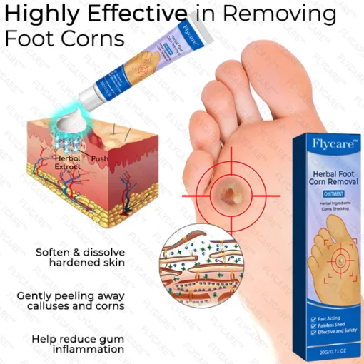 FLYCARE™ Herbal Foot Corn Removal Ointment - Image 7