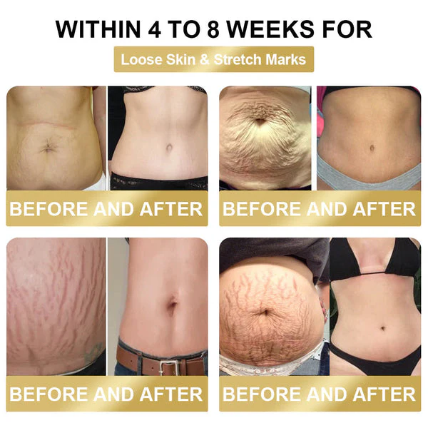 Bee Venom Lymphatic DrainageSlimming Patch - Image 10