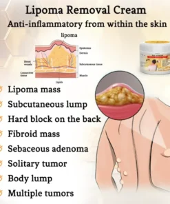 Alternative view of Bee Venom Lipoma Removal Cream