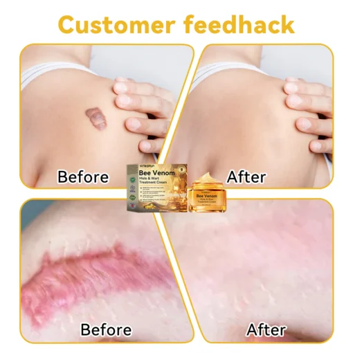 DOCTIA™ Bee Venom Medical Grade Scar Remove Advanced Gel - Image 12