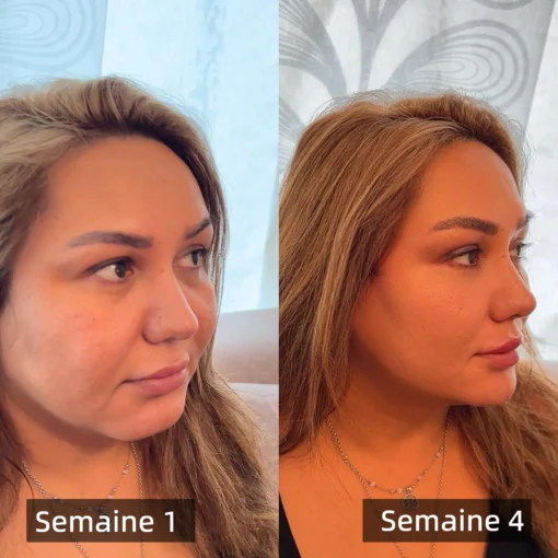 Cvreoz™ Le patch amincissant au venin d’abeille - Image 7