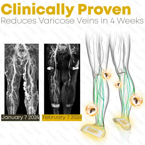 FLYCARE™ Bee Venom Varicosities Healing Pads - Image 5