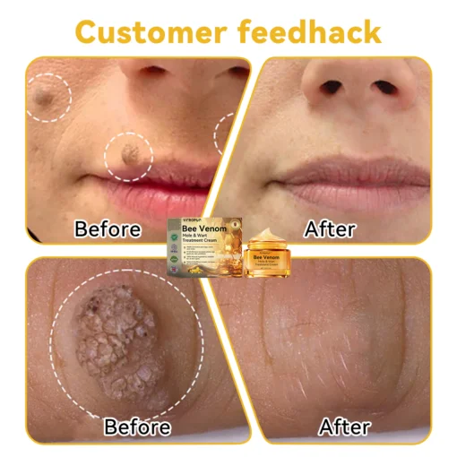 DOCTIA™ Bee Venom Medical Grade Scar Remove Advanced Gel - Image 7