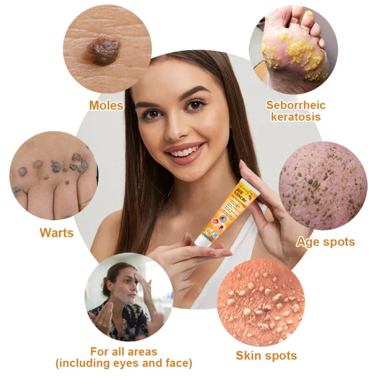 SEAGRIL™ Bee Venom Wart & Tag Removal Cream - Image 7