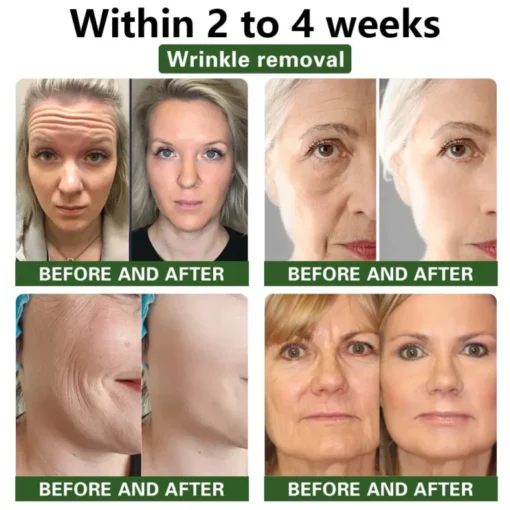 𝑨𝑨𝑭𝑸™ serum za učvršćivanje kože puževa - Slika 6