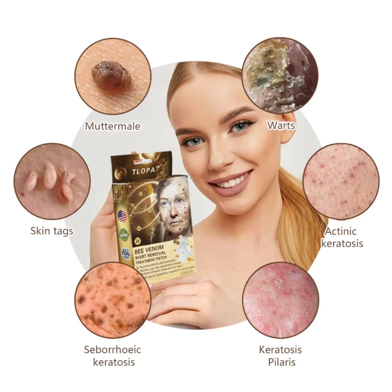 TLOPA™ Bee Venom Wart Removal Treatment Patch - Ofbylding 5