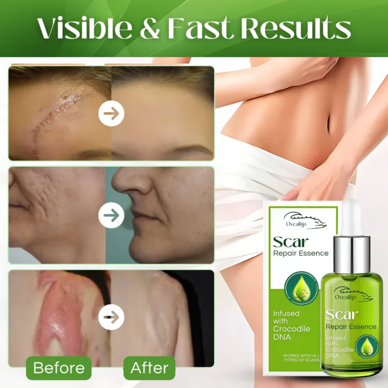 Oveallgo™ Scar Repair Essence - Image 6